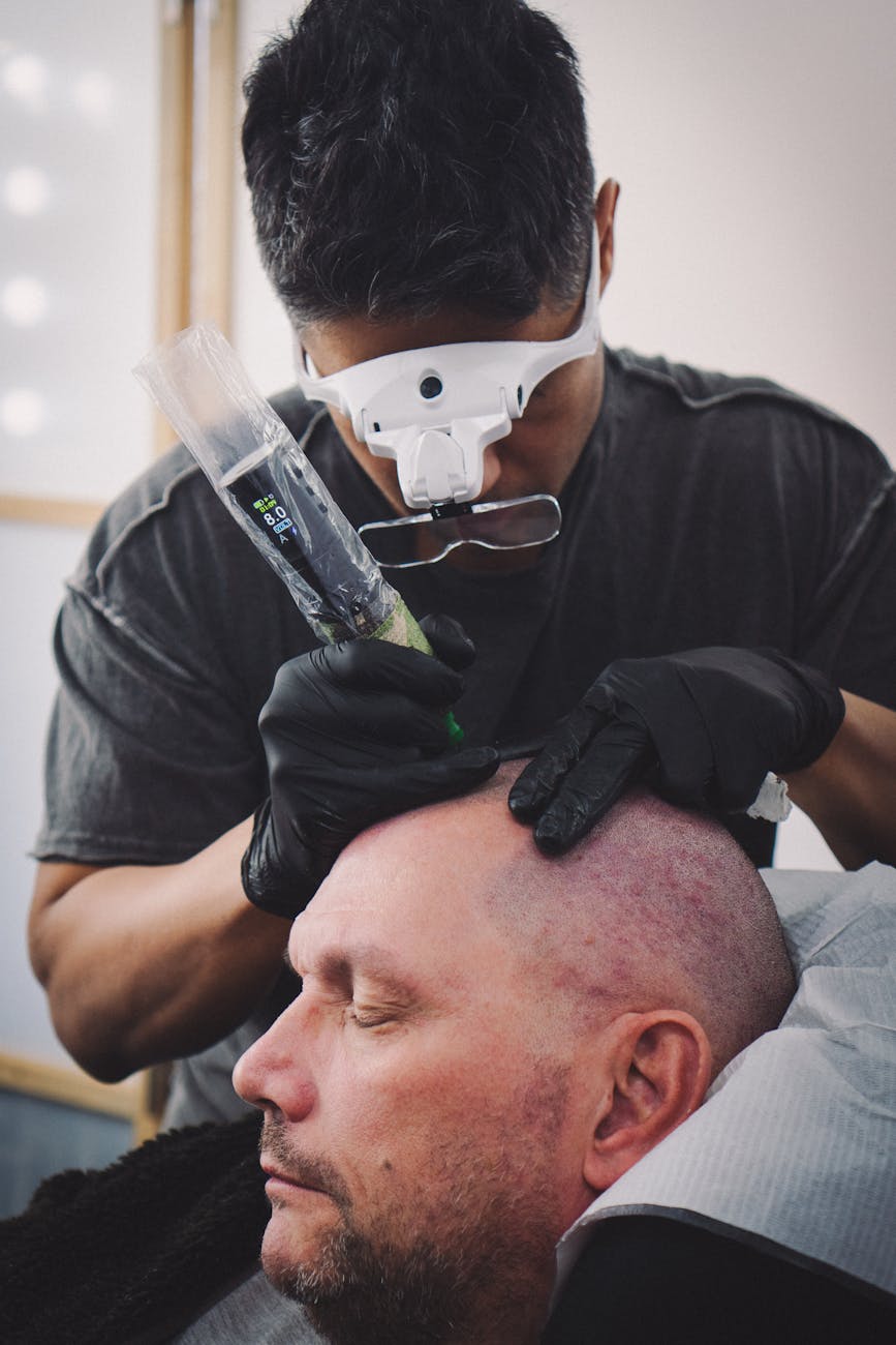 Scalp Micro Pigmentation